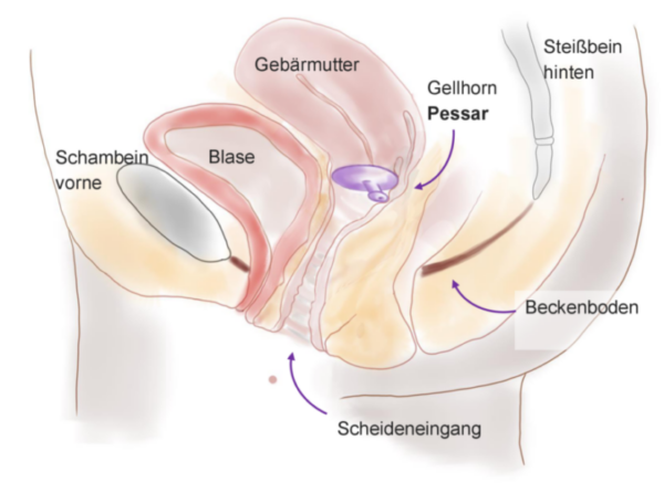 Vaginalpessar Grafik